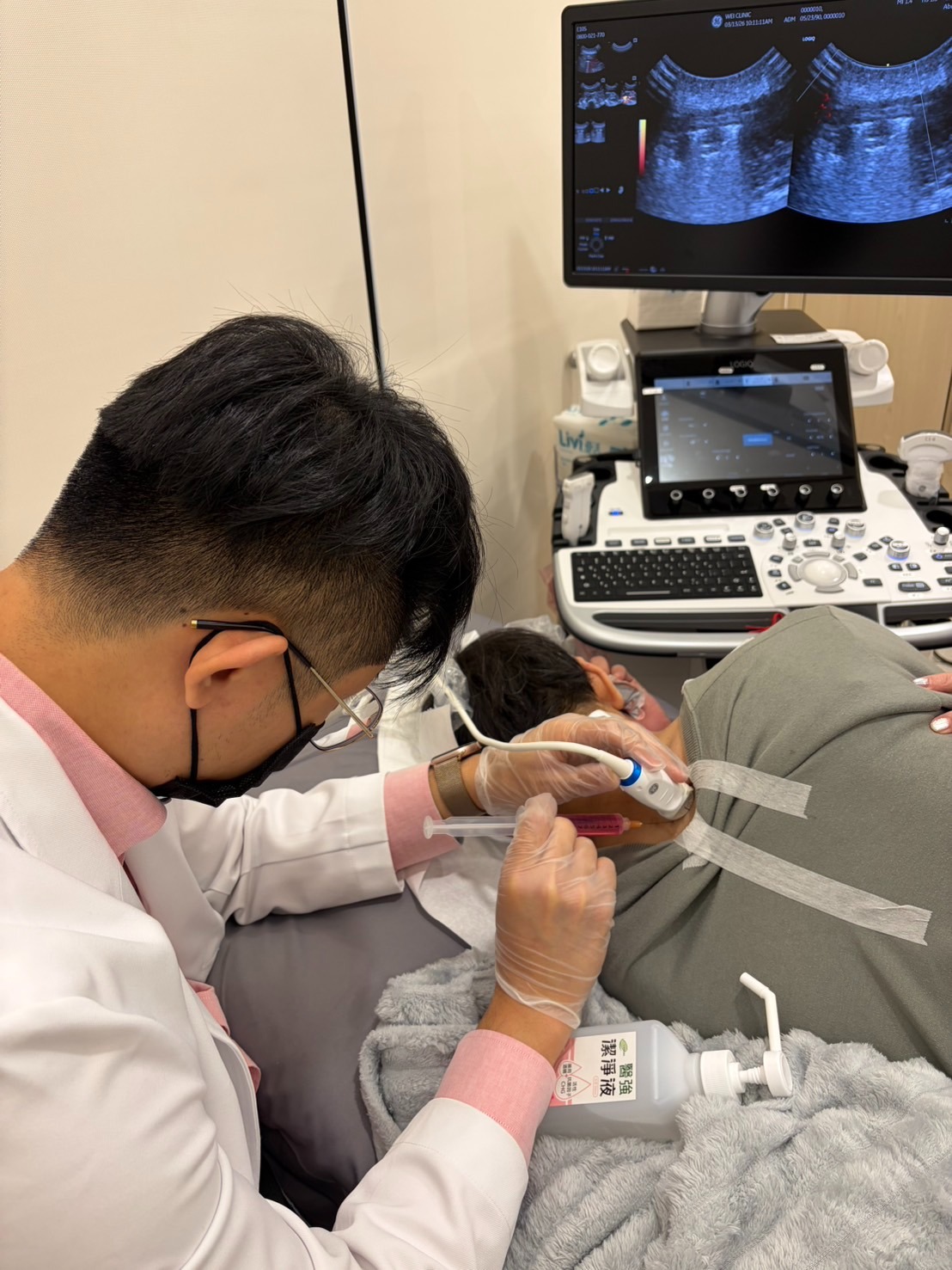 PRP患者治療-台北維醫